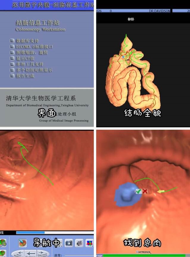 虚拟内窥云