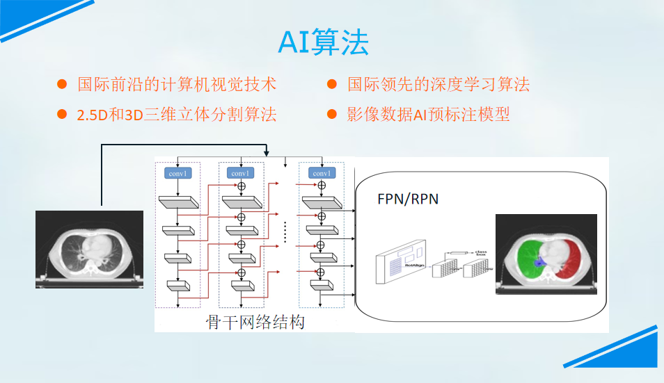 人工智能放疗